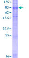 SLC6A4 / SERT Protein - 12.5% SDS-PAGE of human SLC6A4 stained with Coomassie Blue