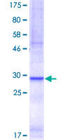 SLC6A4 / SERT Protein - 12.5% SDS-PAGE Stained with Coomassie Blue.