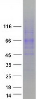 SLC6A4 / SERT Protein - Purified recombinant protein SLC6A4 was analyzed by SDS-PAGE gel and Coomassie Blue Staining