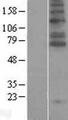 SLC6A5 / GLYT2 Protein - Western validation with an anti-DDK antibody * L: Control HEK293 lysate R: Over-expression lysate