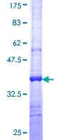 SLC6A5 / GLYT2 Protein - 12.5% SDS-PAGE Stained with Coomassie Blue.