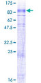 SLC6A7 Protein - 12.5% SDS-PAGE of human SLC6A7 stained with Coomassie Blue