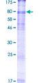 SLC6A8 Protein - 12.5% SDS-PAGE of human SLC6A8 stained with Coomassie Blue