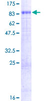 SLC7A1 / CAT1 Protein - 12.5% SDS-PAGE of human SLC7A1 stained with Coomassie Blue