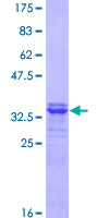 SLC7A1 / CAT1 Protein - 12.5% SDS-PAGE Stained with Coomassie Blue.