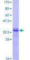 SLC7A1 / CAT1 Protein - 12.5% SDS-PAGE Stained with Coomassie Blue.