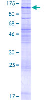 SLC7A14 Protein - 12.5% SDS-PAGE of human SLC7A14 stained with Coomassie Blue