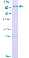 SLC7A2 Protein - 12.5% SDS-PAGE of human SLC7A2 stained with Coomassie Blue