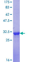 SLC7A2 Protein - 12.5% SDS-PAGE Stained with Coomassie Blue.