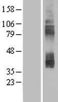 SLC7A3 / CAT-3 Protein - Western validation with an anti-DDK antibody * L: Control HEK293 lysate R: Over-expression lysate
