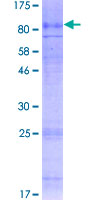 SLC7A4 Protein - 12.5% SDS-PAGE of human SLC7A4 stained with Coomassie Blue