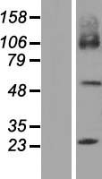 SLC7A7 Protein - Western validation with an anti-DDK antibody * L: Control HEK293 lysate R: Over-expression lysate