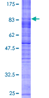 SLC7A7 Protein - 12.5% SDS-PAGE of human SLC7A7 stained with Coomassie Blue
