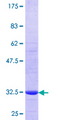 SLC7A7 Protein - 12.5% SDS-PAGE Stained with Coomassie Blue.
