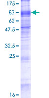 SLC7A8 / LAT2 Protein - 12.5% SDS-PAGE of human SLC7A8 stained with Coomassie Blue