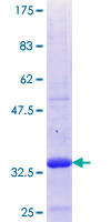 SLC7A8 / LAT2 Protein - 12.5% SDS-PAGE Stained with Coomassie Blue.