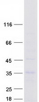SLC7A8 / LAT2 Protein - Purified recombinant protein LAT2 was analyzed by SDS-PAGE gel and Coomassie Blue Staining