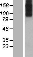 SLC8A3 / NCX3 Protein - Western validation with an anti-DDK antibody * L: Control HEK293 lysate R: Over-expression lysate