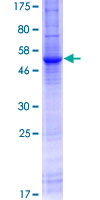 SLC8A3 / NCX3 Protein - 12.5% SDS-PAGE of human SLC8A3 stained with Coomassie Blue