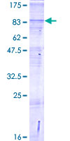 SLC8B1 / SLC24A6 / NCLX Protein - 12.5% SDS-PAGE of human SLC24A6 stained with Coomassie Blue