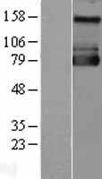 SLC9A1 / NHE1 Protein - Western validation with an anti-DDK antibody * L: Control HEK293 lysate R: Over-expression lysate