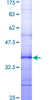 SLC9A1 / NHE1 Protein - 12.5% SDS-PAGE Stained with Coomassie Blue.