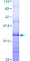 SLC9A1 / NHE1 Protein - 12.5% SDS-PAGE Stained with Coomassie Blue.