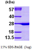SLC9A1BP / CHP Protein