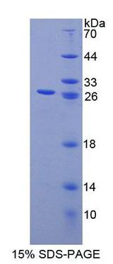 SLC9A1BP / CHP Protein - Recombinant Calcium Binding Protein P22 By SDS-PAGE