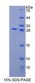SLC9A1BP / CHP Protein - Recombinant Calcium Binding Protein P22 By SDS-PAGE
