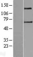 SLC9A2 / NHE2 Protein - Western validation with an anti-DDK antibody * L: Control HEK293 lysate R: Over-expression lysate