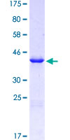 SLC9A3 / NHE3 Protein - 12.5% SDS-PAGE Stained with Coomassie Blue.