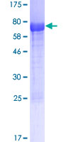SLC9A3R1 / NHERF1 / EBP50 Protein - 12.5% SDS-PAGE of human SLC9A3R1 stained with Coomassie Blue