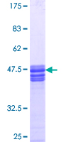 SLC9A3R1 / NHERF1 / EBP50 Protein - 12.5% SDS-PAGE Stained with Coomassie Blue.