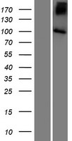SLC9A5 / NHE5 Protein - Western validation with an anti-DDK antibody * L: Control HEK293 lysate R: Over-expression lysate