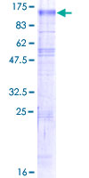 SLC9A6 Protein - 12.5% SDS-PAGE of human SLC9A6 stained with Coomassie Blue