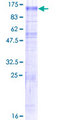 SLC9A6 Protein - 12.5% SDS-PAGE of human SLC9A6 stained with Coomassie Blue