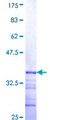 SLC9A6 Protein - 12.5% SDS-PAGE Stained with Coomassie Blue.
