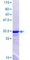 SLC9A9 / NHE9 Protein - 12.5% SDS-PAGE Stained with Coomassie Blue.