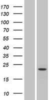 SLC9B1 / NHEDC1 Protein - Western validation with an anti-DDK antibody * L: Control HEK293 lysate R: Over-expression lysate