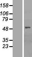 SLCO1B1 / OATP2 Protein - Western validation with an anti-DDK antibody * L: Control HEK293 lysate R: Over-expression lysate