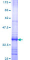 SLCO1B1 / OATP2 Protein - 12.5% SDS-PAGE Stained with Coomassie Blue.