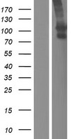 SLCO1B3 / OATP8 Protein - Western validation with an anti-DDK antibody * L: Control HEK293 lysate R: Over-expression lysate