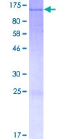 SLFN11 Protein - 12.5% SDS-PAGE of human SLFN11 stained with Coomassie Blue