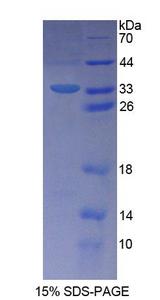SLFN12L Protein - Recombinant  Schlafen Family Member 5 By SDS-PAGE
