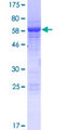 SLFN5 Protein - 12.5% SDS-PAGE of human SLFN5 stained with Coomassie Blue