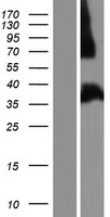 SLIM / FHL1 Protein - Western validation with an anti-DDK antibody * L: Control HEK293 lysate R: Over-expression lysate