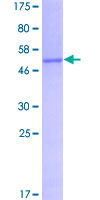 SLIM / FHL1 Protein - 12.5% SDS-PAGE of human FHL1 stained with Coomassie Blue