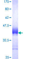 SLIM / FHL1 Protein - 12.5% SDS-PAGE Stained with Coomassie Blue.