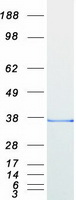 SLIM / FHL1 Protein - Purified recombinant protein FHL1 was analyzed by SDS-PAGE gel and Coomassie Blue Staining